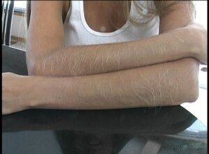 Amateur female Lori Anderson displays her really hairy arms on nudesceleb.com